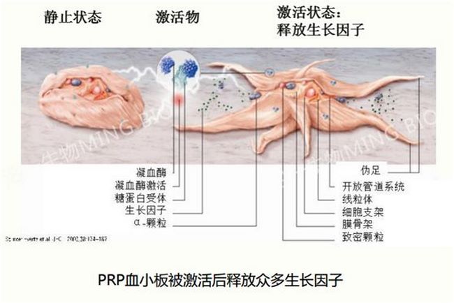 云顶集团yd1233检测网址首次开展PRP治疗难治性外伤(图5)