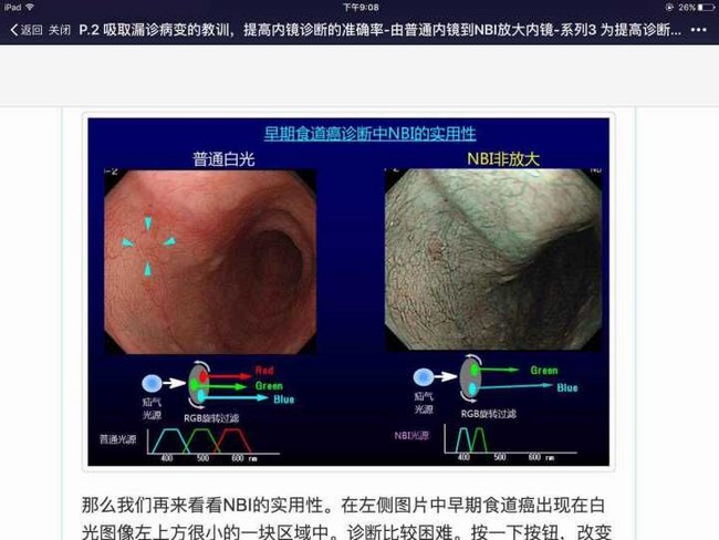 国际一流胃肠内窥镜系统助力我院镜诊疗水平更上新的台阶(图1)