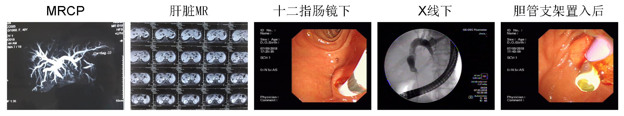 内镜创新工作永远在路上(图9)