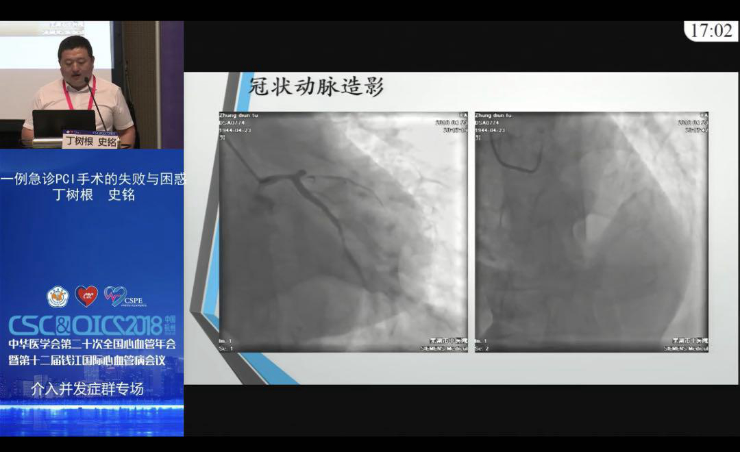 我院心内科受邀在2018全国心血管年会做精彩病例报告(图4)