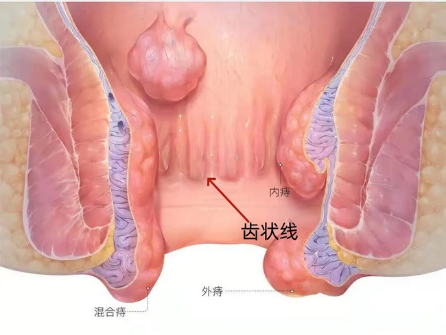 图片1_副本 肛肠 (Copy).jpg