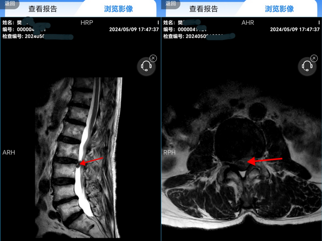 针灸2 (Copy).png