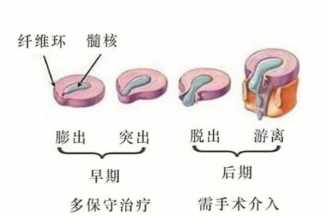 针灸1 (Copy).png